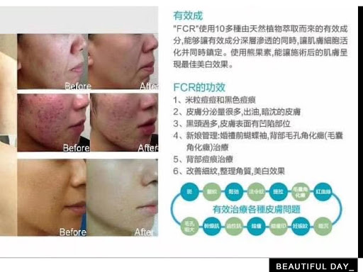 Lovely Face 美容院