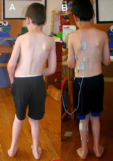 Judy Carmick, Physical Therapist - Thumbnail