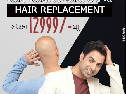 Fabulous Diwali Offer on your Hair Replacement post image
