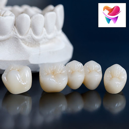 Dreaming of a natural-looking, confident smile without metal? At Om Shivkrupa Dental Charitable T… post image