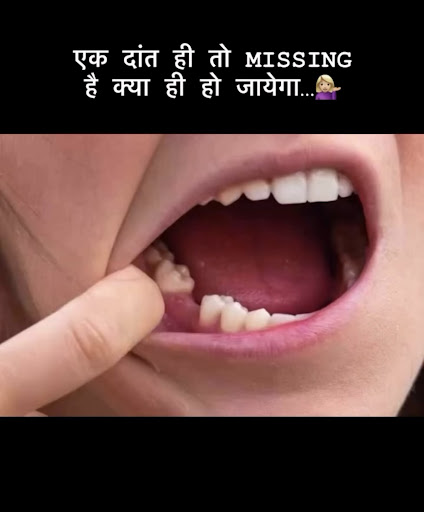 • पास के दांत धीरे-धीरे अपनी जगह से हिलने लगते हैं post image