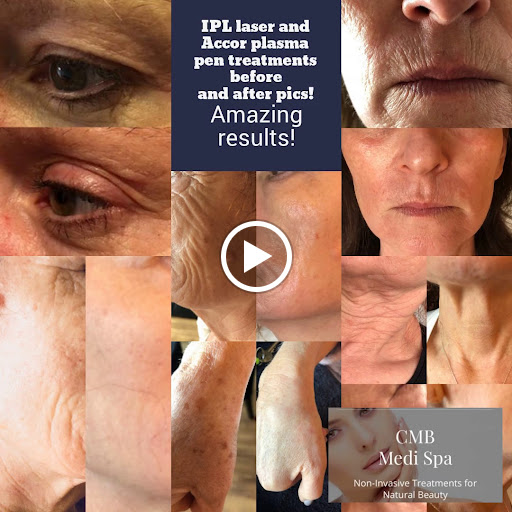 CMB Medispa Plymouth