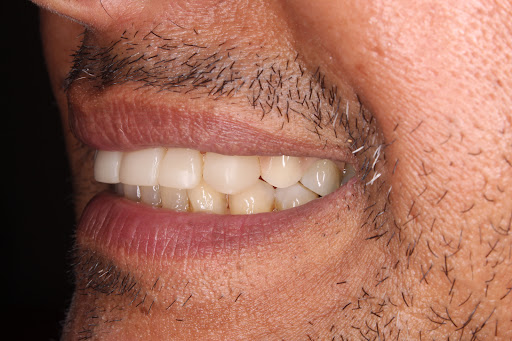 Dental Beauty - Creando Sonrisas Gallery - Mexico