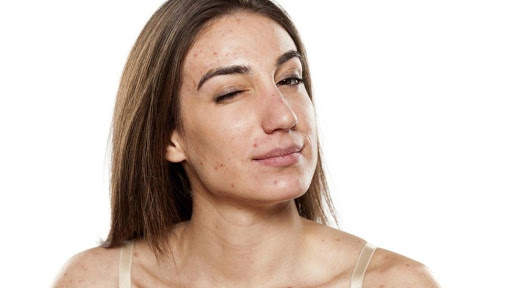 Alpha Dermatology of PA, LLC - Board Certified Dermatology - Thumbnail