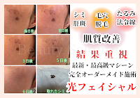 シミ・肝斑/毛穴/ニキビ/肌質改善/Beauty Salon 桜