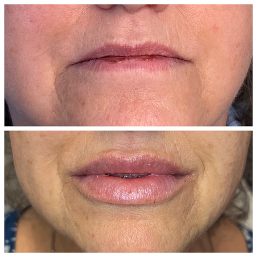 Cheeky Medspa- Fairbanks