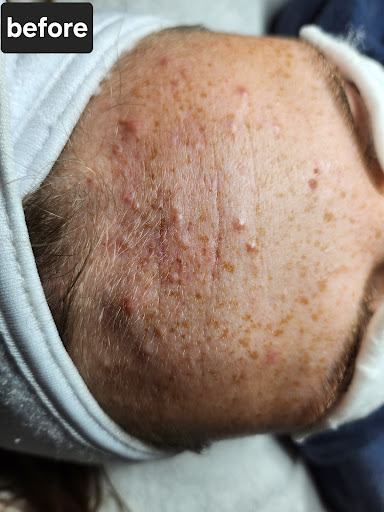 Elevated Glow Esthetics - Thumbnail