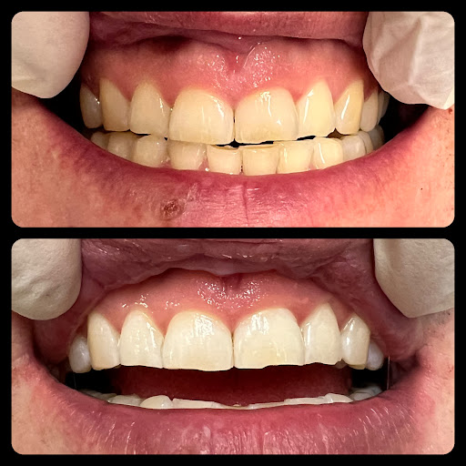 Stomatologia, tanie Implanty, Protetyka, Leczenie kanałowe Wybielanie Dentysta Warszawa Mokotów Wilanowska