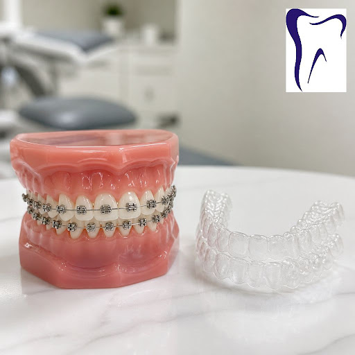 Thinking about straightening your teeth but confused between traditional braces and clear aligner… post image
