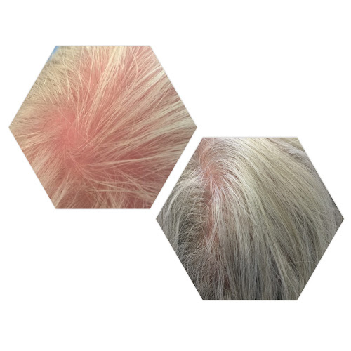 Hair Loss Clinic - Preston - Beauty salon