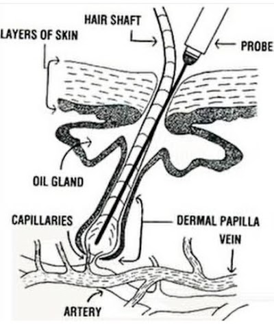 Grand Junction Electrolysis