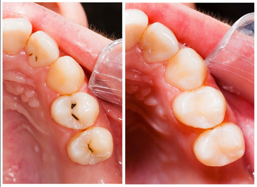 Village Dental - All General, Cosmetic, Implant & Orthodontic Dentistry and Denture Clinic - Thumbnail