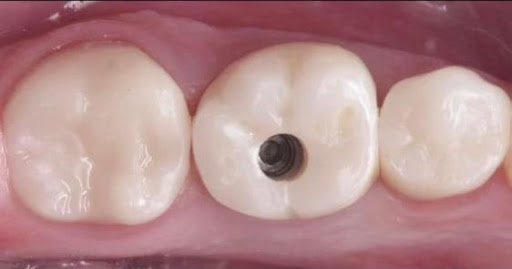 CLÍNICA DENTAL CANCÚN Always Smile