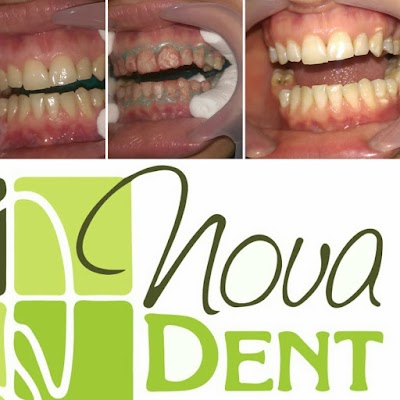 Klinike Dentare Nova Dent (Dr. Ela Dragoti)