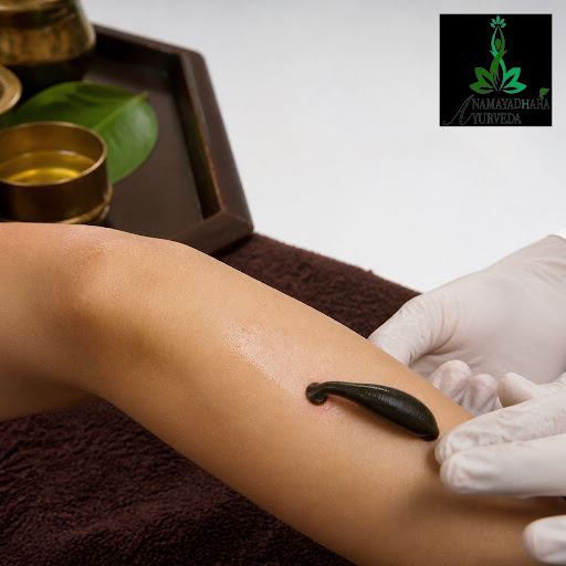 Struggling with stubborn skin problems, varicose veins, or chronic blood-related issues? At Anama… post image