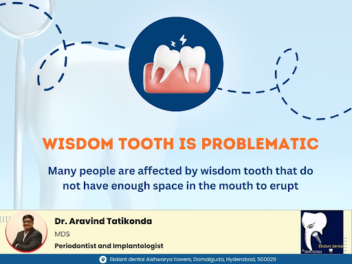 Wisdom Tooth is Problematic. post image