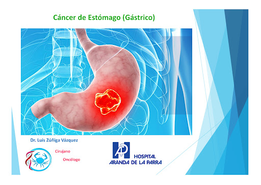 Cirujano Oncólogo - Dr. Luis Abraham Zúñiga Vázquez - Thumbnail
