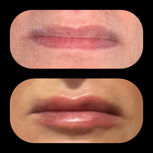 Phoenix Rising Esthetics LLC
