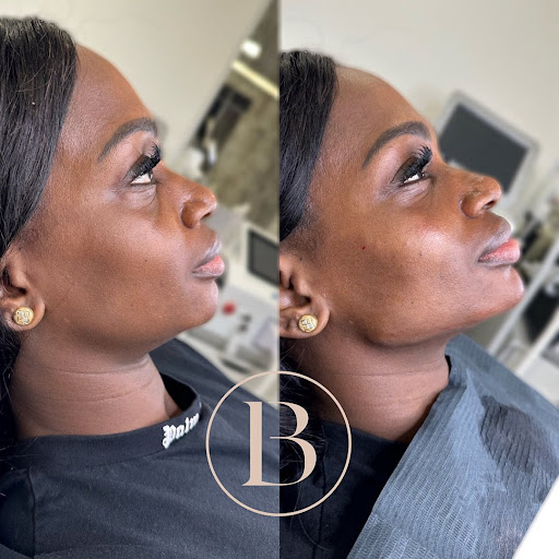 Bespoke @No16 Medispa Perth