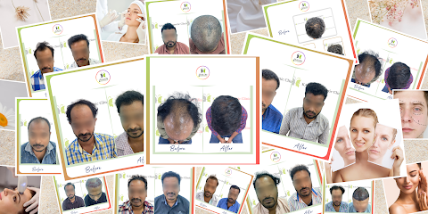 KALON Hair Transplant & Cosmetic Clinic | Best Hair Transplant Clinic in Visakhapatnam | Hair Clinic in Vizag