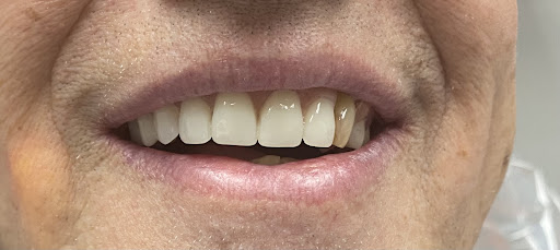 Lehigh Valley Cosmetic Dentistry - Thumbnail