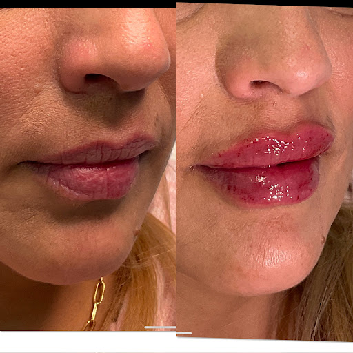 Brilliant Beauty Aesthetics Laser Clinic