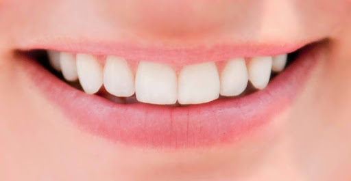 Chester Road Dental Care : Dr Lisa-Marie Kitchen BDS.