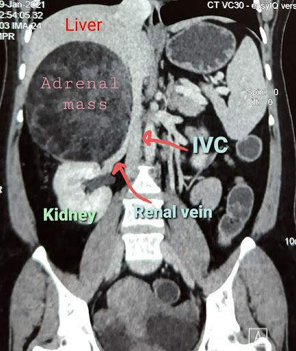 Gallery image 1092