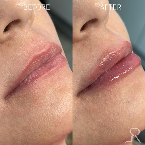 Roberts Aesthetics and Wellness