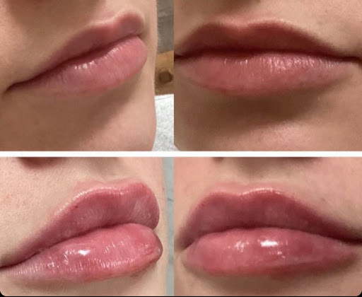 YOUKALPH SPA - Visual