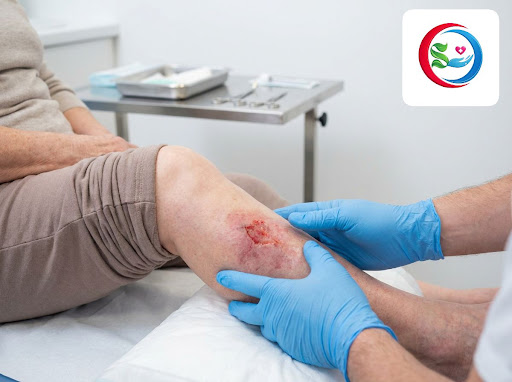 Slow or non-healing wounds can be dangerous, especially if you have diabetes or poor circulation.… post image