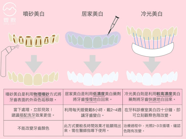 桃園•中壢•青埔|豐煦牙醫診所|全瓷冠貼片/植牙推薦/牙齒矯正/牙周水雷