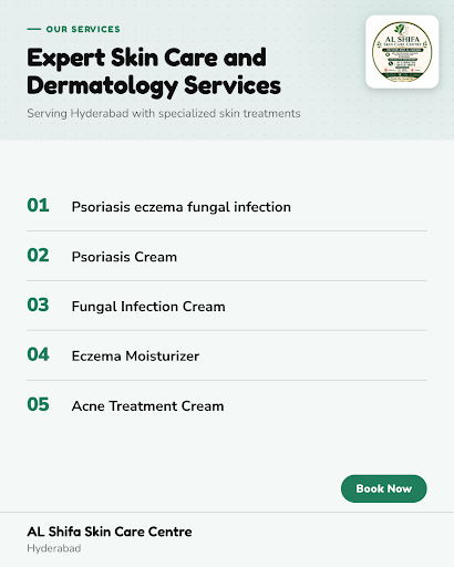 AL Shifa Skin Care Centre in Hyderabad specializes in treating psoriasis eczema fungal infection… post image