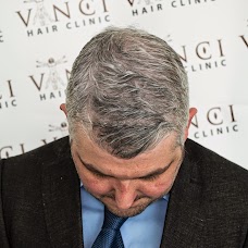 Vinci Hair Clinic manchester