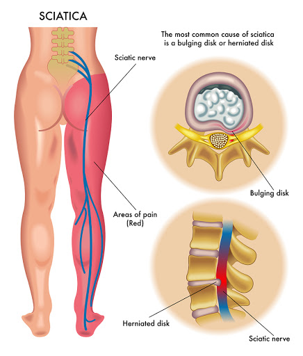 Studio di Terapia Manuale, Osteopatia e Fisioterapia Dott. Sirna Giancarlo - Thumbnail