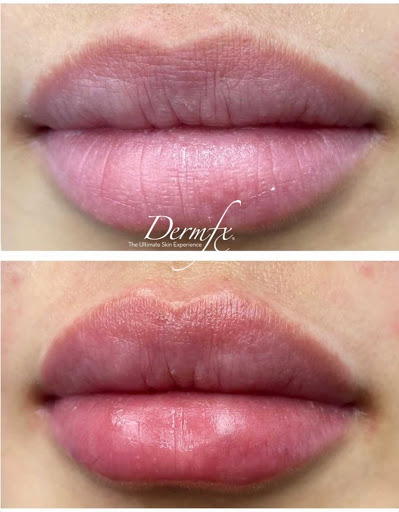 DermFx Redondo Beach - Thumbnail
