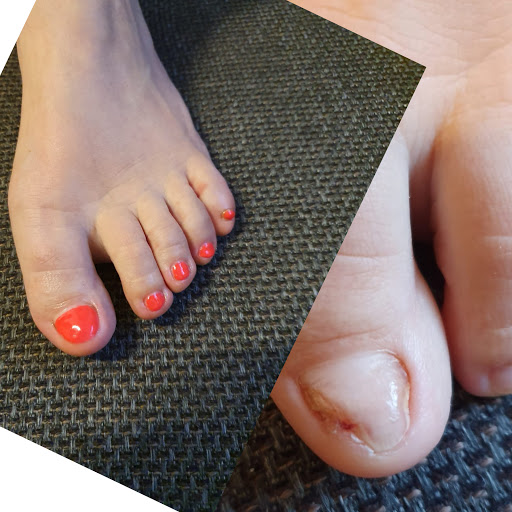 Perfekt-Lashes Gallery - Germany