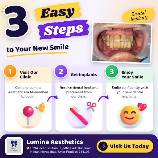 Discover quality dental implants in three easy steps at Lumina Aesthetics, a good dental clinic n… post image