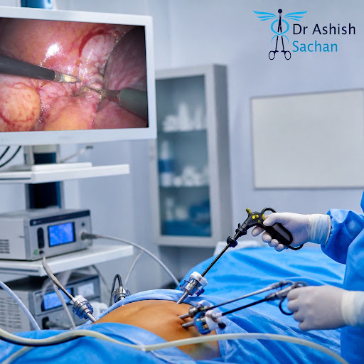 Tired of repeated pain and acidity due to gallbladder stones? At Dr Ashish Sachan - Shalimar Bagh… post image