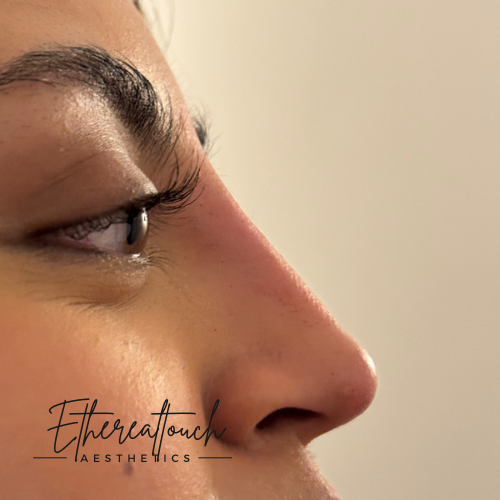 Etherealtouch Aesthetics - Thumbnail