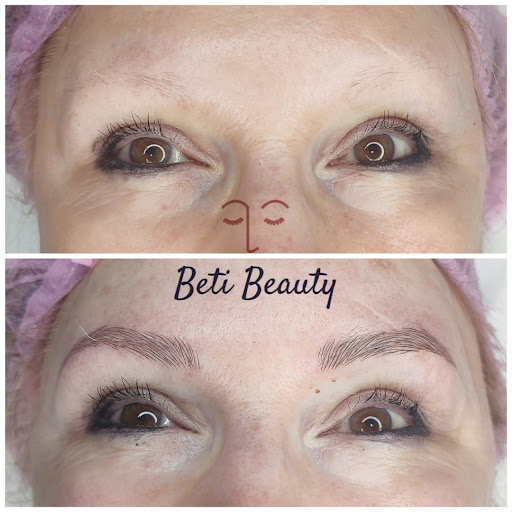 Beti Beauty estética - Thumbnail