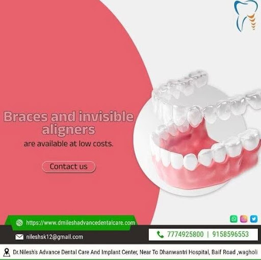 Invisible aligners and braces treatment corrects dental crowding, closes spacing discrepancies, a… post image