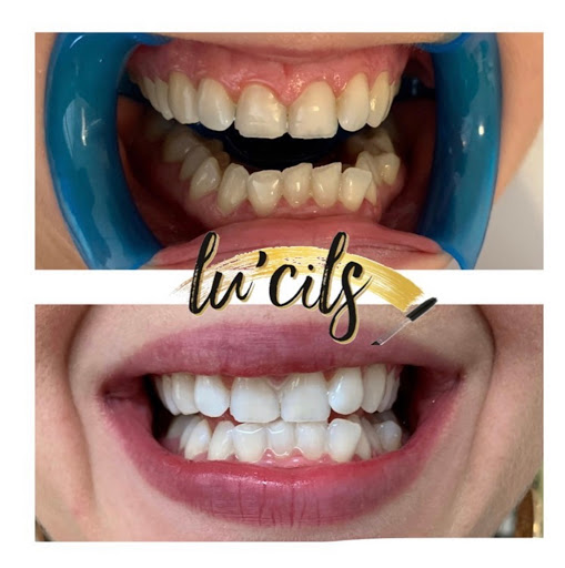 Lu'cils - Thumbnail