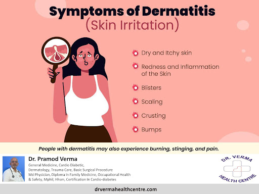 Know the symptoms of Dermatitis post image