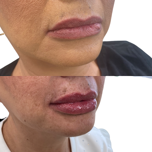 Intoxicated Injectables