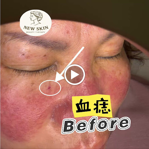 New Skin Beauty Therapy