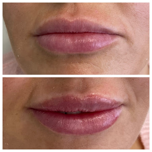 Levore Aesthetics Med Spa