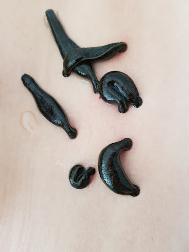 Hipnoza Pijawki Homeopatia Marian Bajorek