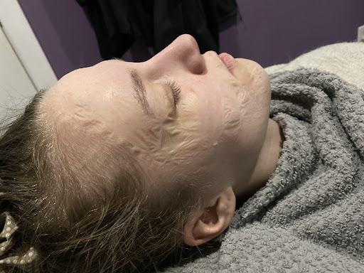 Tbeau Laser and Skin Rejuvenation Centre - Thumbnail