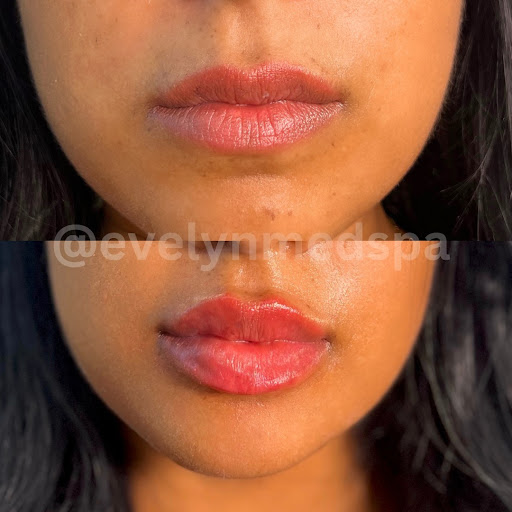 Evelyn Med Spa